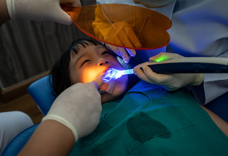 A curing light being used on a dental restoration during treatment